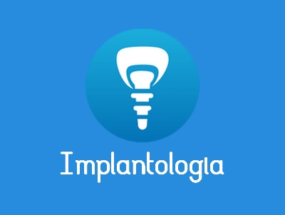 implantologia quartu